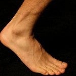 Fodskade